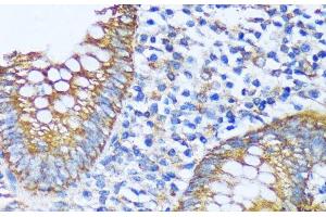 Immunohistochemistry of paraffin-embedded Human appendix using ACOT2 Polyclonal Antibody at dilution of 1:100 (40x lens).