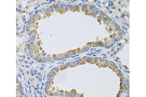 Immunohistochemistry of paraffin-embedded Mouse lung using AP2B1 Polyclonal Antibody at dilution of 1:100 (40x lens). (AP2B1 antibody)
