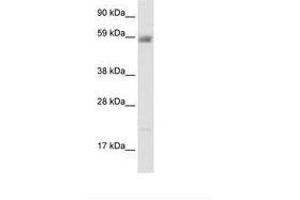 Image no. 2 for anti-Amiloride-Sensitive Cation Channel 3 (ACCN3) (AA 53-102) antibody (ABIN202724) (ASIC3 antibody  (AA 53-102))