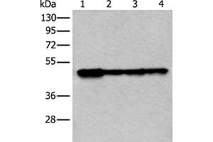 Western blot analysis of 293T and 231 cell lysates using VRK1 Polyclonal Antibody at dilution of 1:400 (VRK1 antibody)