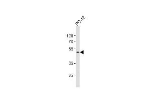Anti-PIP4K2A Antibody (C-term)at 1:1000 dilution + PC-12 whole cell lysates Lysates/proteins at 20 μg per lane. (PIP4K2A antibody  (C-Term))