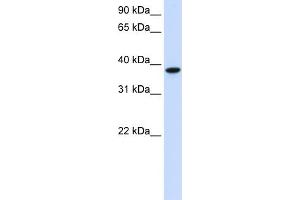 WB Suggested Anti-GLT8D2 Antibody Titration:  0. (GLT8D2 antibody  (C-Term))