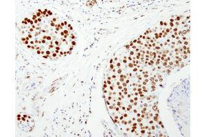 anti-Nuclear Mitotic Apparatus Protein 1 (NUMA1) (AA 900-950) antibody