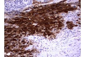 Image no. 4 for anti-Thymidylate Synthetase (TYMS) antibody (ABIN1501595)