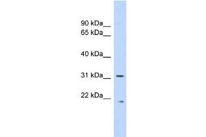 WB Suggested Anti-CAPNS1 Antibody Titration: 0. (Calpain S1 antibody  (Middle Region))