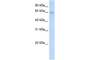 CYP2E1 antibody used at 1 ug/ml to detect target protein. (CYP2E1 antibody  (C-Term))