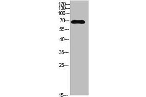 Western blot analysis of MCF7 SW480 MOUSE-LIVER mouse-lung MOUSE-KIDNEY lysate, antibody was diluted at 500. (IL16 antibody  (AA 900-960))