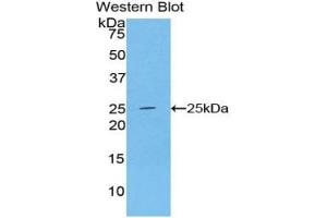 Western blot analysis of the recombinant protein. (ADH1 antibody  (AA 169-370))