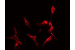 ABIN6274216 staining Hela cells by IF/ICC. (RPL10 antibody  (N-Term))