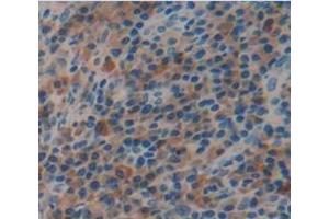IHC-P analysis of Human Tissue, with DAB staining. (FBLN4 antibody  (AA 17-169))