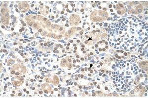 Human kidney (ST8SIA2 antibody  (C-Term))