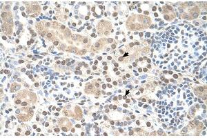 Human kidney (ST8SIA2 antibody  (C-Term))