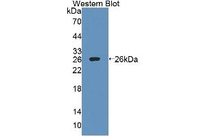 Figure. (IL27 Receptor alpha antibody  (AA 93-273))
