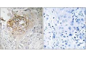 Immunohistochemistry (IHC) image for anti-Sodium Channel, Voltage-Gated, Type IX, alpha Subunit (SCN9A) (AA 651-700) antibody (ABIN1535378)