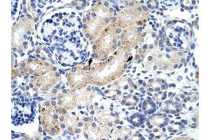 ZFP57 antibody was used for immunohistochemistry at a concentration of 4-8 ug/ml to stain Epithelial cells of renal tubule (arrows) in Human Kidney.