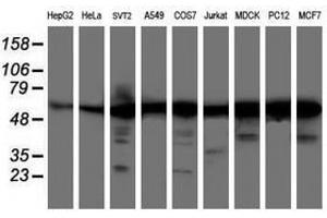 Image no. 1 for anti-V-Akt Murine Thymoma Viral Oncogene Homolog 1 (AKT1) antibody (ABIN1496558) (AKT1 antibody)