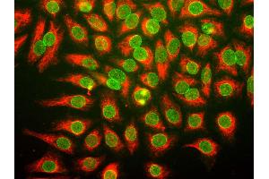HeLa cells were stained with anti-nuclear pore complex antibody (green), and chicken anti-vimentin (red). (Nuclear Stain of Multiple Gene Products Including Nup62, Nup133 antibody)