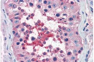 Immunohistochemistry (Paraffin-embedded Sections) (IHC (p)) image for anti-Chemokine (C-X-C Motif) Receptor 4 (CXCR4) (AA 14-40) antibody (ABIN461996)