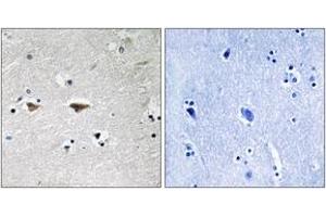 Immunohistochemistry analysis of paraffin-embedded human brain tissue, using Src (Ab-75) Antibody. (Src antibody  (AA 41-90))