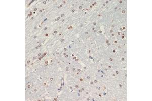 Immunohistochemistry of paraffin-embedded rat brain using Olig2 antibody (ABIN6128396, ABIN6145015, ABIN6145016 and ABIN6216575) at dilution of 1:200 (40x lens). (OLIG2 antibody  (AA 1-80))