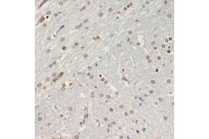 Immunohistochemistry of paraffin-embedded rat brain using Olig2 antibody (ABIN6128396, ABIN6145015, ABIN6145016 and ABIN6216575) at dilution of 1:200 (40x lens).