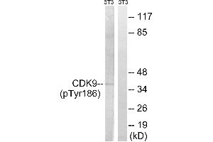Western blot analysis of extracts from 3T3 cells, treated with Forskolin (40nM, 30mins), using CDK9 (Phospho-Thr186) antibody. (CDK9 antibody  (pThr186))