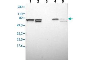 Western blot analysis of Lane 1: RT-4, Lane 2: U-251 MG, Lane 3: Human Plasma, Lane 4: Liver, Lane 5: Tonsil with SETD3 polyclonal antibody  at 1:250-1:500 dilution. (SETD3 antibody)