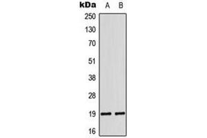 Western blot analysis of LATH expression in DU145 (A), K562 (B) whole cell lysates. (LATH antibody  (Center))
