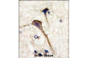 Formalin-fixed and paraffin-embedded human brain tissue reacted with INA antibody , which was peroxidase-conjugated to the secondary antibody, followed by DAB staining. (INA antibody  (AA 290-319))