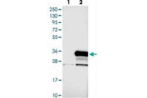 Western blot analysis of Lane 1: Negative control (vector only transfected HEK293T lysate), Lane 2: Over-expression Lysate (Co-expressed with a C-terminal myc-DDK tag (~3. (N4BP2L1 antibody)