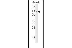 Image no. 1 for anti-SUMO1 Activating Enzyme Subunit 2 (UBA2) (C-Term) antibody (ABIN356597) (UBA2 antibody  (C-Term))