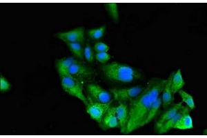Immunofluorescent analysis of Hela cells using ABIN7168489 at dilution of 1:100 and Alexa Fluor 488-congugated AffiniPure Goat Anti-Rabbit IgG(H+L) (RUNX3 antibody  (AA 1-415))