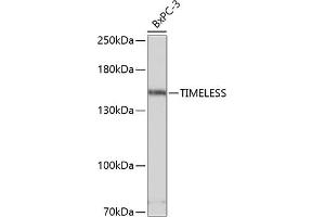 Western blot analysis of extracts of BxPC-3 cells, using TIMELESS antibody (ABIN1683038, ABIN3018743, ABIN3018744 and ABIN6220565) at 1:3000 dilution. (TIMELESS antibody  (AA 969-1208))