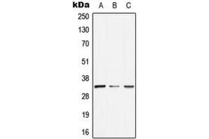 Western blot analysis of GTF2E2 expression in HeLa (A), SP2/0 (B), H9C2 (C) whole cell lysates. (GTF2E2 antibody  (Center))