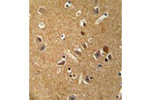 Formalin fixed, paraffin embedded human brain tissue stained with DAGLA Antibody  followed by peroxidase conjugation of the secondary antibody and DAB staining. (DAGLA antibody  (Middle Region))