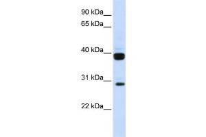 WB Suggested Anti-FLT3LG Antibody Titration:  0.
