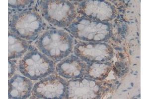 Detection of LPO in Rat Stomach Tissue using Polyclonal Antibody to Lactoperoxidase (LPO) (LPO antibody  (AA 351-589))