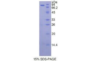 SDS-PAGE analysis of Human HSP90aB1 Protein. (Heat Shock Protein 90kDa alpha B1 Protein)
