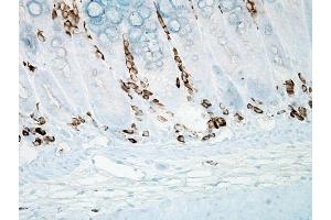 Immunohistochemistry analysis using Mouse Anti-Nitrotyrosine Monoclonal Antibody, Clone 39B6 . (Nitrotyrosine antibody  (Atto 390))