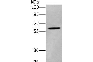 Western blot analysis of Human cerebrum tissue lysate using ZKSCAN1 Polyclonal Antibody at dilution of 1:400