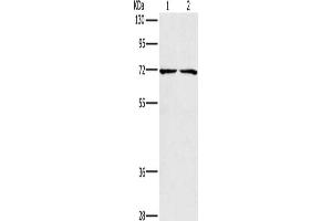 Gel: 8 % SDS-PAGE, Lysate: 40 μg, Lane 1-2: Lovo cells, 293T cells, Primary antibody: ABIN7128941(CHRNA4 Antibody) at dilution 1/200, Secondary antibody: Goat anti rabbit IgG at 1/8000 dilution, Exposure time: 5 seconds (CHRNA4 antibody)