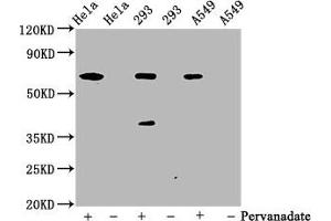 Western Blot Positive WB detected in Hela whole cell lysate ? (Recombinant PTPN11 antibody  (pTyr542))