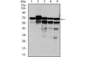 Western blot analysis using RPA1 mouse mAb against HeLa (1), MCF-7 (2), K562(3), A431(4), and COS-7 (6) cell lysate. (RPA1 antibody)