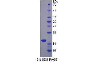 Image no. 1 for Sideroflexin 1 (SFXN1) (AA 2-102) protein (His tag) (ABIN4989577)