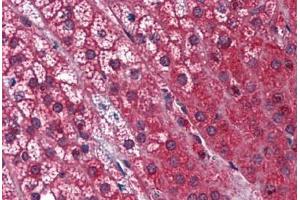 Human Adrenal: Formalin-Fixed, Paraffin-Embedded (FFPE) (STK16 antibody  (AA 1-306))
