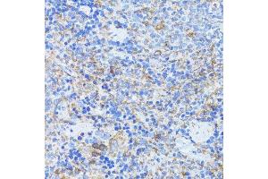 Immunohistochemistry of paraffin-embedded rat spleen using ARRB1 antibody. (beta Arrestin 1 antibody  (AA 169-418))