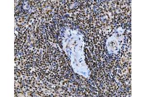 IHC analysis of UBC12/UBE2M using anti-UBC12/UBE2M antibody (ABIN7600885).