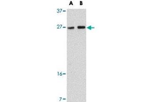 Western blot analysis of TMEM18 in rat brain tissue lysate with TMEM18 polyclonal antibody  at (A) 0. (Transmembrane Protein 18 (TMM18) (C-Term) antibody)