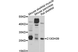 Western blot analysis of extracts of various cell lines, using METTL21C antibody (ABIN5998216) at 1/1000 dilution. (METTL21C antibody)