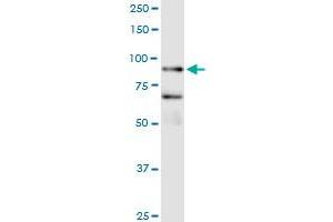 Immunoprecipitation of FBXO40 transfected lysate using anti-FBXO40 MaxPab rabbit polyclonal antibody and Protein A Magnetic Bead , and immunoblotted with FBXO40 purified MaxPab mouse polyclonal antibody (B01P) . (FBXO40 antibody  (AA 1-709))